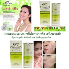 Botaya Tinospora Serum เซรั่มโบทาย่า หรือ เซรั่มบอระเพ็ด สมุนไพรสูตรมหัศจรรย์ ช่วยลด ปัญหาสิวอุดตัน สิวเสี้ยน ริ้วรอย ร่องลึก รูขุมขนกว้าง ผิวไม่กระชับ 15ml. 9 ชิ้น Botaya Tinospora Serum เซรั่มโบทาย่า หรือ เซรั่มบอระเพ็ด สมุนไพรสูตรมหัศจรรย์ ช่วยลด ปัญหาสิวอุดตัน สิวเสี้ยน ริ้วรอย ร่องลึก รูขุมขนกว้าง ผิวไม่กระชับ 15ml. 9 ชิ้น