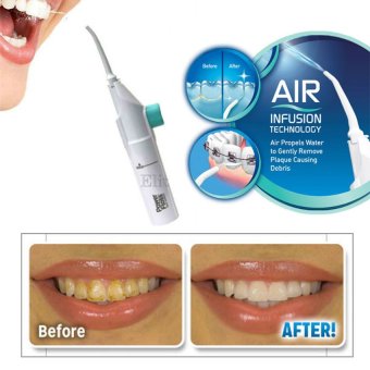 เสนอราคา Sinlin อุปกรณ์ดูแลช่องปาก อุปกรณ์ทำความสะอาดฟัน Power floss เสนอราคา Sinlin อุปกรณ์ดูแลช่องปาก อุปกรณ์ทำความสะอาดฟัน Power floss